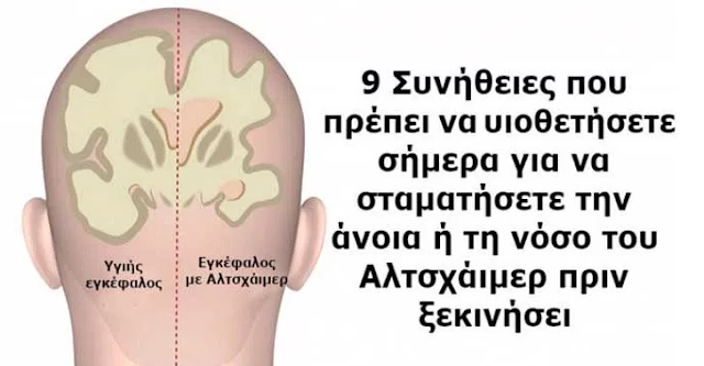 9 πράγματα που μπορείτε να κάνετε σήμερα για να μην πάθετε αλτσχάιμερ όταν γεράσετε