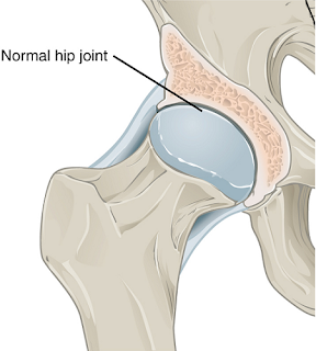 Normal hip joint