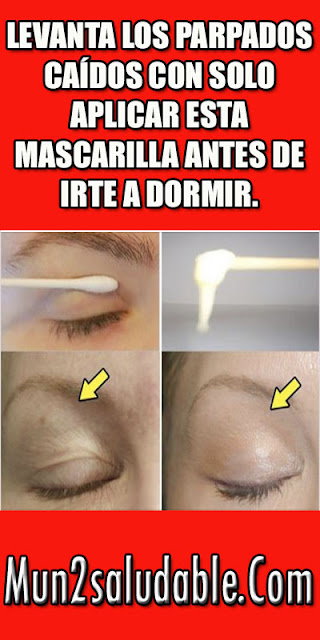 Levanta-los-parpados-caídos-con-solo-aplicar-esta-mascarilla-antes-de-irte-a-dormir. Levanta-los-parpados-caídos-con-solo-aplicar-esta-mascarilla-antes-de-irte-a-dormir.