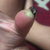 Jovem perde pedaço do dedo após manutenção em unhas de acrigel