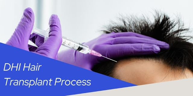 DHI Hair Transplant Process