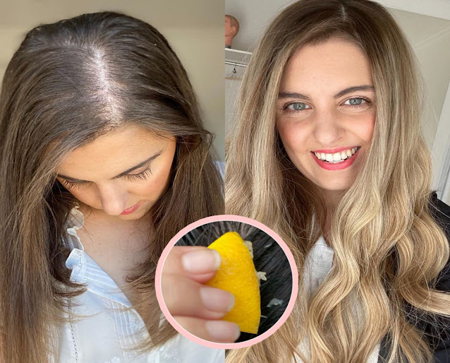Stopper la chute de cheveux et d