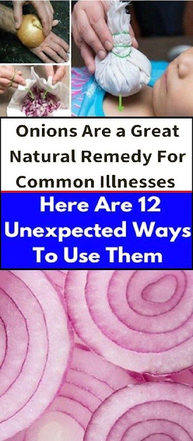 Onions Are A Great Natural Remedy For Common Illnesses – Here Are 12 Unexpected Ways To Use Them