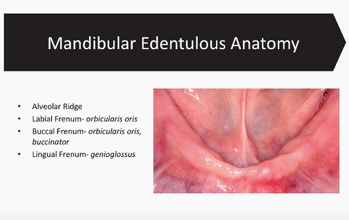 PROSTHODONTICS: Mandibular Edentulous Anatomy