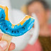 Vì sao răng sứ bị lỏng? Giải pháp khắc phục