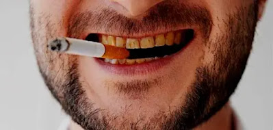 التدخين خطر علي صحة الأسنان