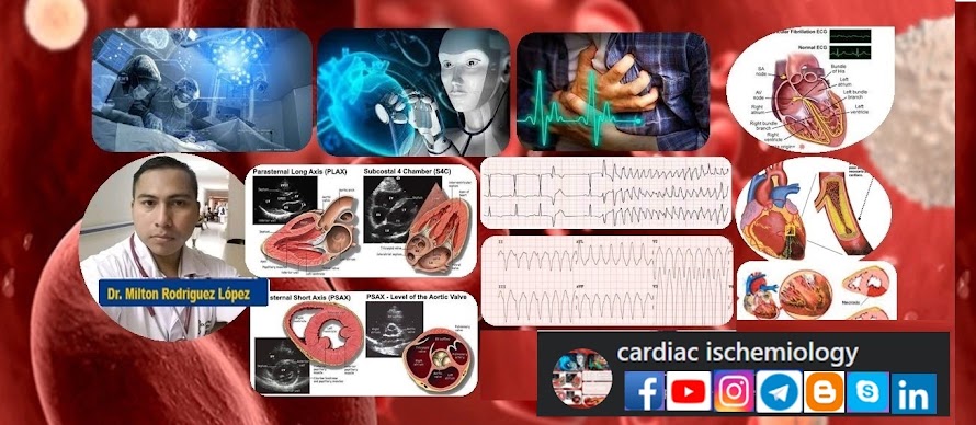 cardiac ischemiology