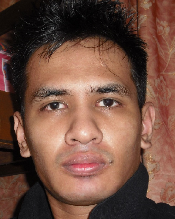 Adobe Photoshop Learning: Skin Repair & Reconstruction in Adobe Photoshop