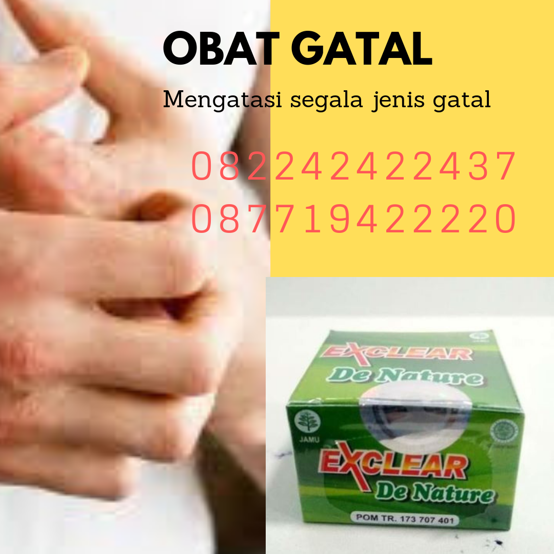 obat gatal alami: Obat panu kadas kurap paling ampuh