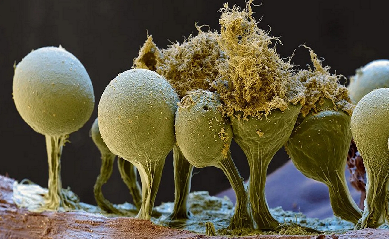 Грибы споры в организме. Плесневые грибы в микроскопе. Зеленая плесень под микроскопом. Плесневелые грибы под микроскопом. Грибы микромицеты.