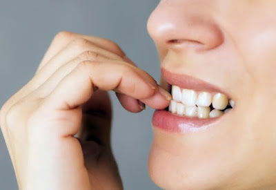 Tại sao cần thực hiện niềng răng móm?