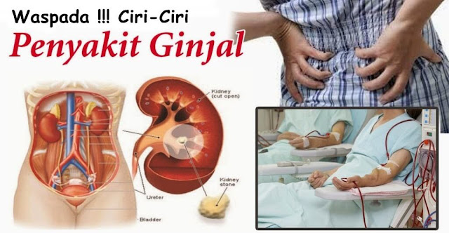 Penyakit Ginjal: Ciri-ciri, Penyebab dan gejala Sejak Awal Hingga Kronis