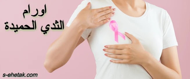 اورام الثدي الحميدة اورام الثدي الحميدة