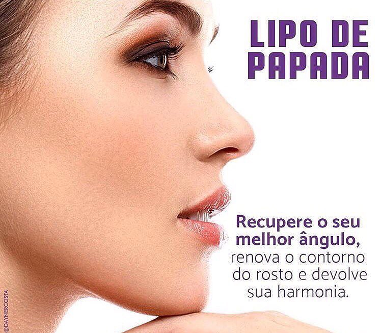 Prof.ª Ms.Mariana Garvil: Lipo Enzimática de Papada