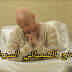 العلاج الكيماوي Chimiothérapie العلاج الكيماوي Chimiothérapie
