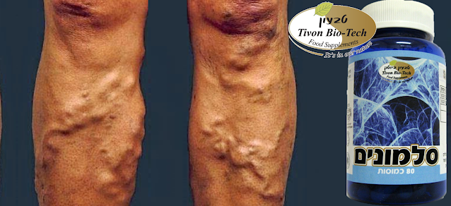 העצמות חלשות אתר ויטמין טבעון