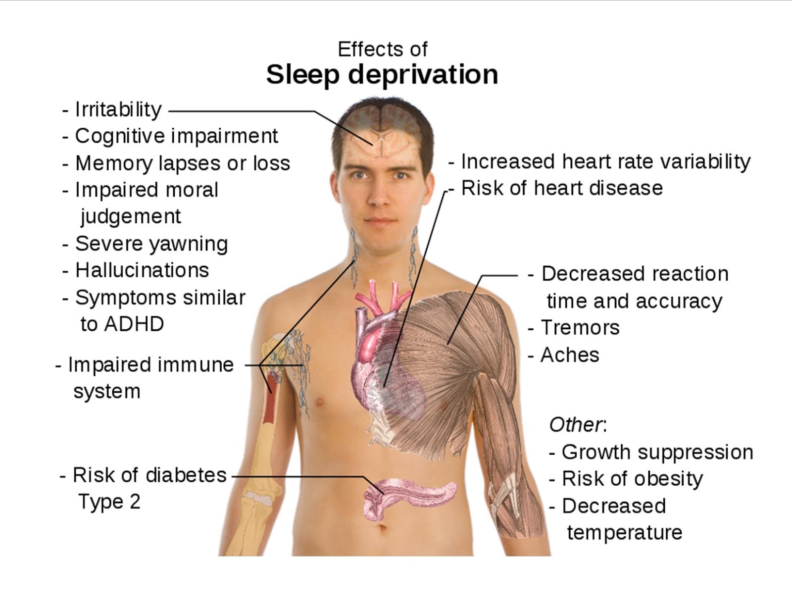 Почему после частная. Последствия бессонницы. Причины плохого сна. Последствия нарушения сна. Причины расстройства сна.