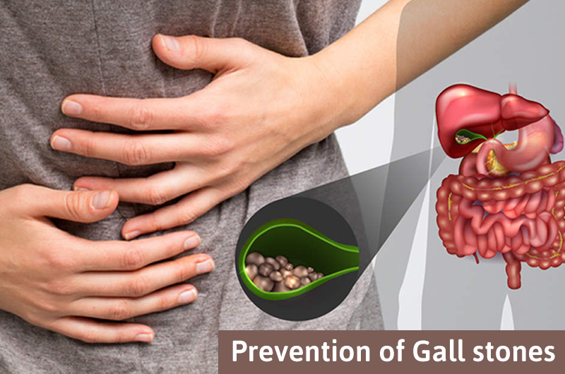 Prevention From Gallstones Chennai Gastro Care