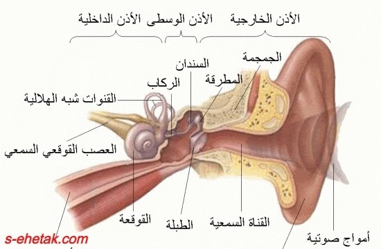 ورم العصب السمعي