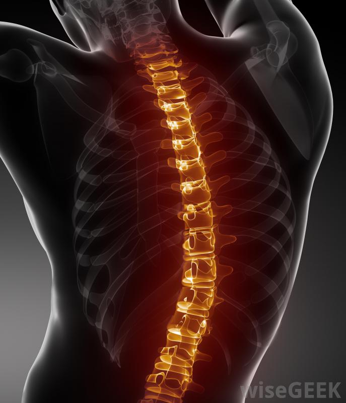 Pott's Diseases syndrome Medical Self Help