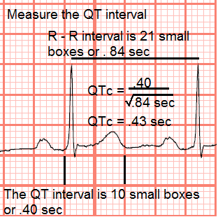 Telemetry Technician Course: Measuring Intervals: QT Intervals (class 4)