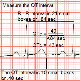 how to calculate qtc manually how to calculate qtc manually