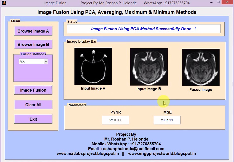 Image Fusion Using PCA on MRI and CT Image Full Matlab Project Code Matlab Project Codes