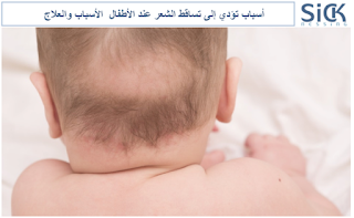 أسباب تؤدي إلى تساقط الشعر عند الأطفال  الأسباب والعلاج