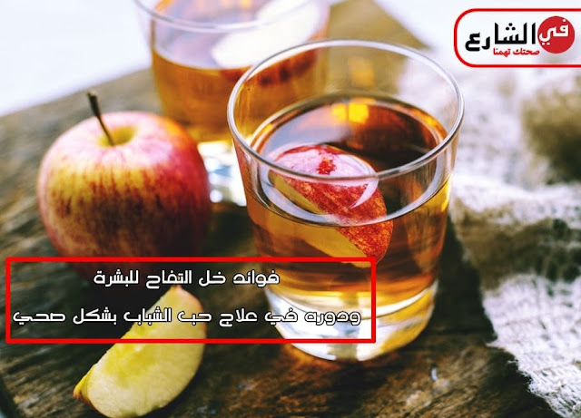 فوائد خل التفاح للبشرة فوائد خل التفاح لعلاج حب الشباب