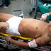"Marcelo Bate-Estaca" permanece na UTI do hospital João Paulo II