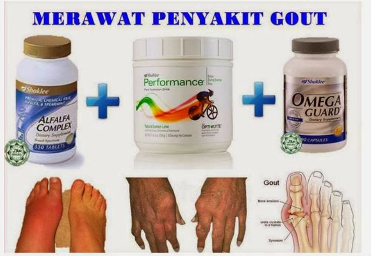 Saranan Vitamin Supplement Shaklee untuk Gout * SWEET MOMS VITAMIN