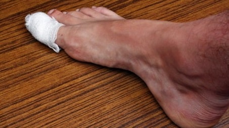 Trauma di area kaki cara mencegah cantengan