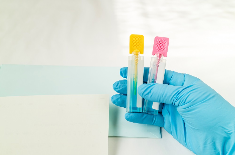 All You Need to Know About a Stool Test