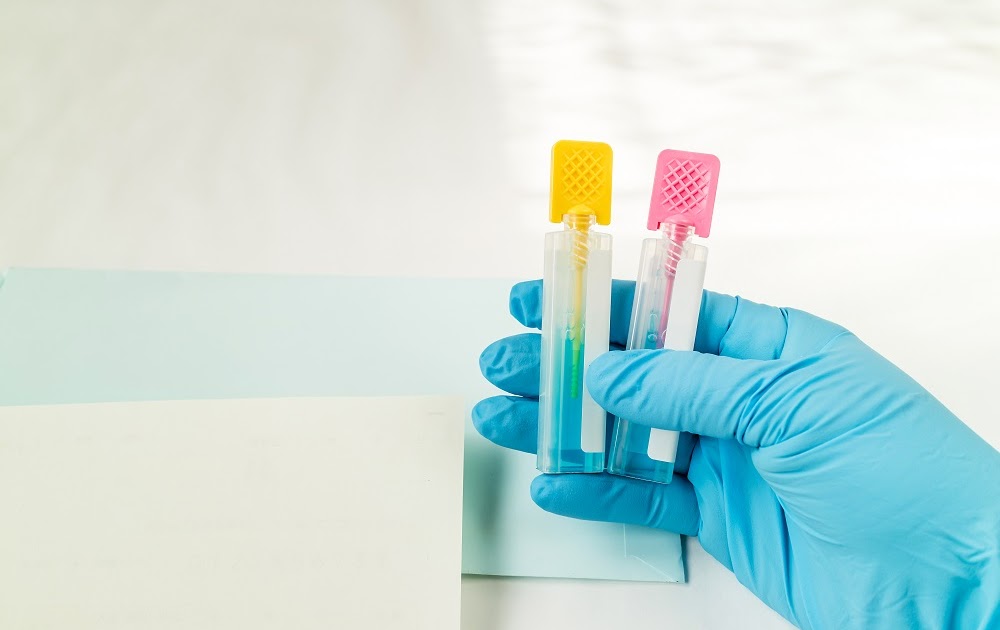 All You Need to Know About a Stool Test