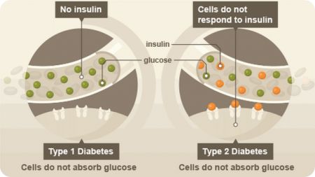 Reverse Type 2 Diabetes Naturally