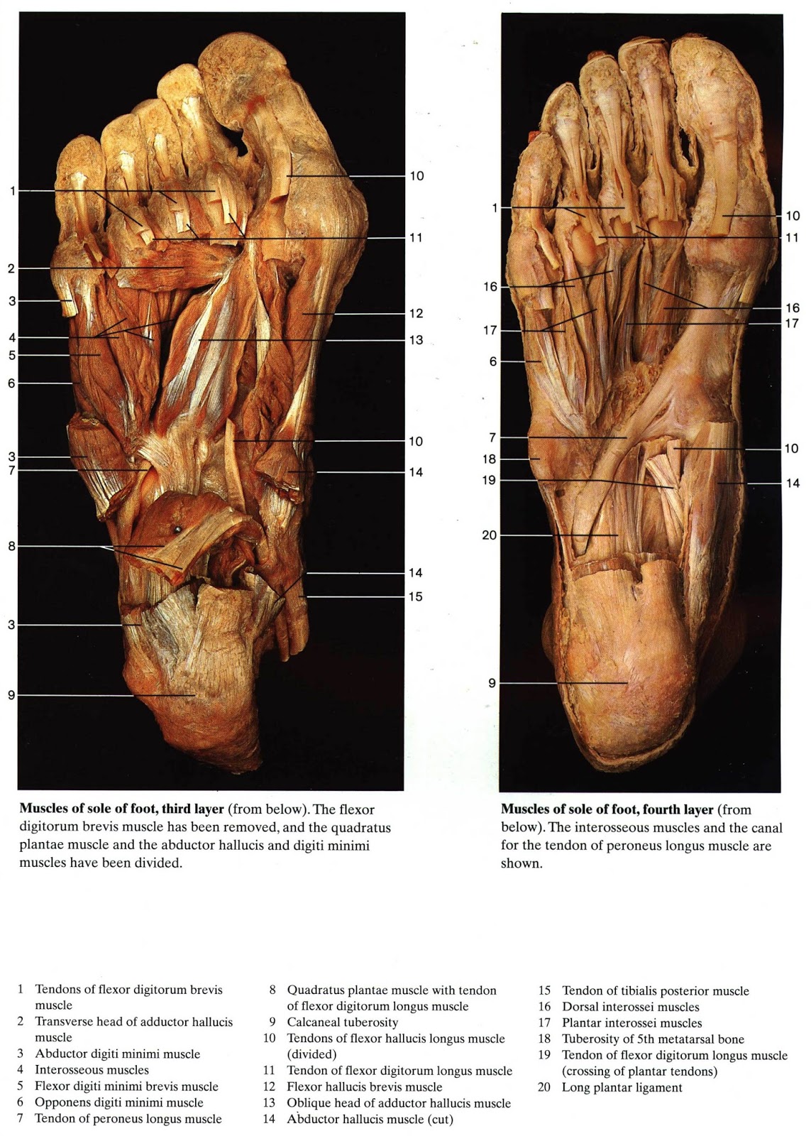 Фото стопы человека с названием. Мышцы стопы анатомия. Мышцы стопы анатомия вид снизу. Мышцы и кости стопы анатомия. Стопа анатомия кости сухожилия.