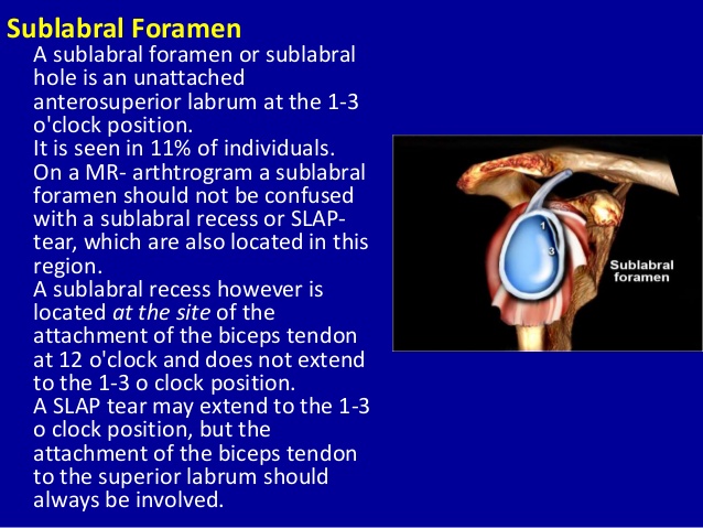 MRI Musculo-Skeletal Section: MRI anatomy of the shoulder (ABER view).