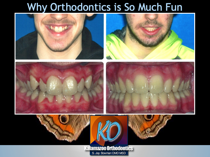 Embracing Innovative Orthodontics Portage, Kalamazoo, Paw Paw, MI