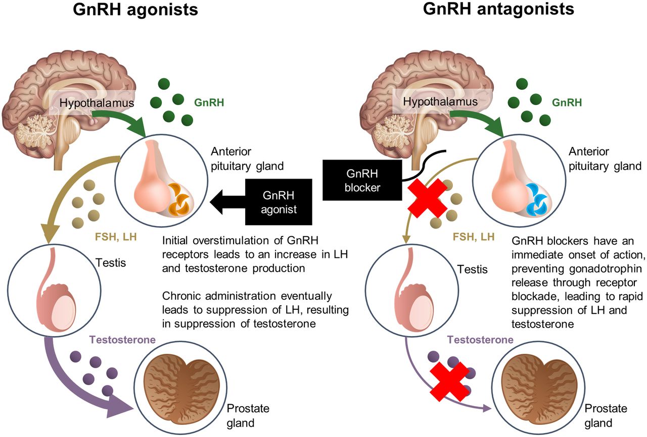 ARVIGEN HEALTHCARE: Cost-effectiveness analysis of GnRH-agonist long ...
