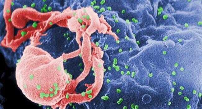 HIV HIV