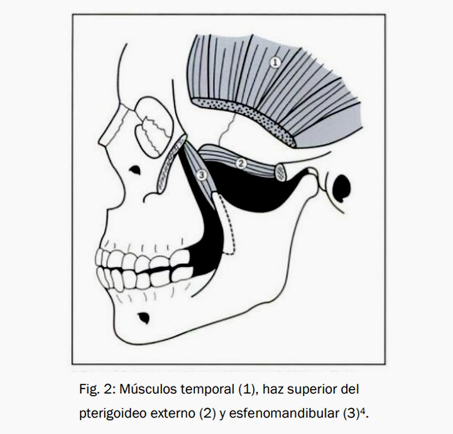 disfunción temporomandibular signos y sintomas de diabetes