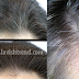 REMEDIOS CASEROS PARA LAS CANAS PREMATURAS