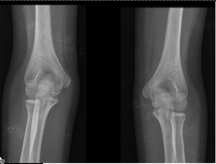 Radiologia: galeria de imagenes