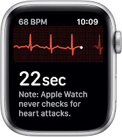 apple watch series 5 ECG
