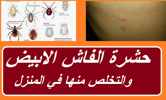 "حشرة الفاش في المنزل" "القضاء على الفاش نهائيا من المنزل" "هل الكلور يقتل الفاش" "حشرة الفاش والانسان" "شكل الفاش الأبيض" "التخلص من الفاش نهائيا من المنزل" "كيف اقضى على الفاش في المنزل" "هل فاش الطيور يعدى الانسان" حشرة الفاش ويكيبيديا " حشرة الفاش الأبيض في المنزل" حشرة الفاش الأبيض" حشرة الفاش" " علاج حشرة الفاش " فاش الطيور حشرة الفاش" حشرة الفاش الابيض 0" حشرة الفاش في المنزل" حشرة الفاش في الطيور" حشرة العلقة" حشرة الجرب" حشرة الحمام" حشرة قمل الحمام" " ما هي حشرة الفاش" حشرة الفاش فى المنزل" حشرة الفاش والانسان" حشرة فاش الحمام" " شكل حشرة الجرب" حشرة الفاش فاش الحمام" حشرة البغبش" حشرة الفاش الأسود" حشرة القميلة" شكل حشرة الفاش" كيفية التخلص من حشرة الفاش فى المنزل" شكل حشرة فاش الطيور" فاش شكل حشرة الفاش" الارنب حشرة" أضرار حشرة السوس" هل الخل يقتل الفاش التخلص من الفاش نهائيا القضاء على الفاش من المنزل القضاء على الفاش نهائيا من المنزل علاج الفاش بالحلبه علاج الفاش عند الانسان علاج الفاش بالثوم هل الفاش ينتقل للانسان حشرة الفاش في المنزل القضاء على الفاش نهائيا من المنزل الفاش الابيض هل الكلور يقتل الفاش شكل الفاش الأبيض كيف اقضى على الفاش في المنزل التخلص من الفاش نهائيا من المنزل علاج قرص الفاش للانسان "حشرة الفاش في المنزل" "القضاء على الفاش نهائيا من المنزل" "هل الكلور يقتل الفاش" "حشرة الفاش والانسان" "شكل الفاش الأبيض" "التخلص من الفاش نهائيا من المنزل" "كيف اقضى على الفاش في المنزل" "هل فاش الطيور يعدى الانسان" حشرة الفاش ويكيبيديا " حشرة الفاش الأبيض في المنزل" حشرة الفاش الأبيض" حشرة الفاش" " علاج حشرة الفاش " فاش الطيور حشرة الفاش" حشرة الفاش الابيض 0" حشرة الفاش في المنزل" حشرة الفاش في الطيور" حشرة العلقة" حشرة الجرب" حشرة الحمام" حشرة قمل الحمام" " ما هي حشرة الفاش" حشرة الفاش فى المنزل" حشرة الفاش والانسان" حشرة فاش الحمام" " شكل حشرة الجرب" حشرة الفاش فاش الحمام" حشرة البغبش" حشرة الفاش الأسود" حشرة القميلة" شكل حشرة الفاش" كيفية التخلص من حشرة الفاش فى المنزل" شكل حشرة فاش الطيور" فاش شكل حشرة الفاش" الارنب حشرة" أضرار حشرة السوس" هل الخل يقتل الفاش التخلص من الفاش نهائيا القضاء على الفاش من المنزل القضاء على الفاش نهائيا من المنزل علاج الفاش بالحلبه علاج الفاش عند الانسان علاج الفاش بالثوم هل الفاش ينتقل للانسان حشرة الفاش في المنزل القضاء على الفاش نهائيا من المنزل الفاش الابيض هل الكلور يقتل الفاش شكل الفاش الأبيض كيف اقضى على الفاش في المنزل التخلص من الفاش نهائيا من المنزل علاج قرص الفاش للانسان