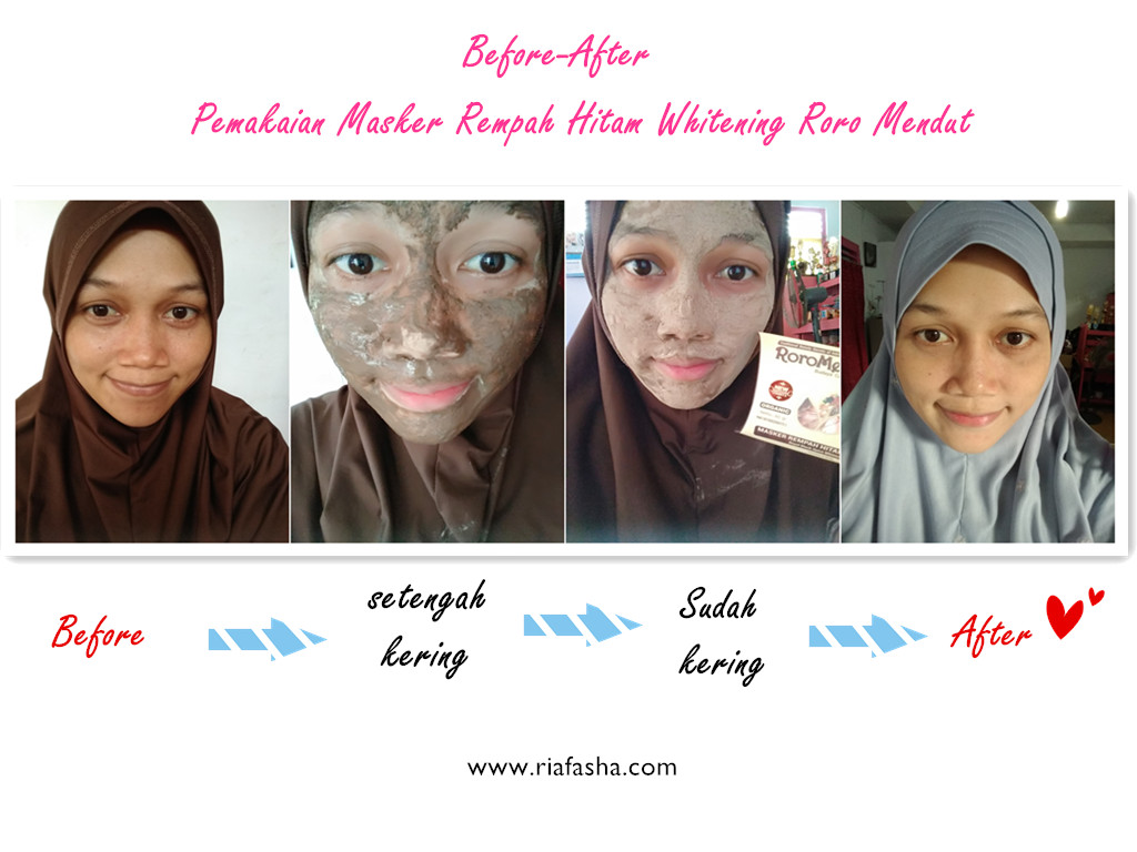 Roro Mendut Masker Brotowali Acne Jerawat Shopee Indonesia