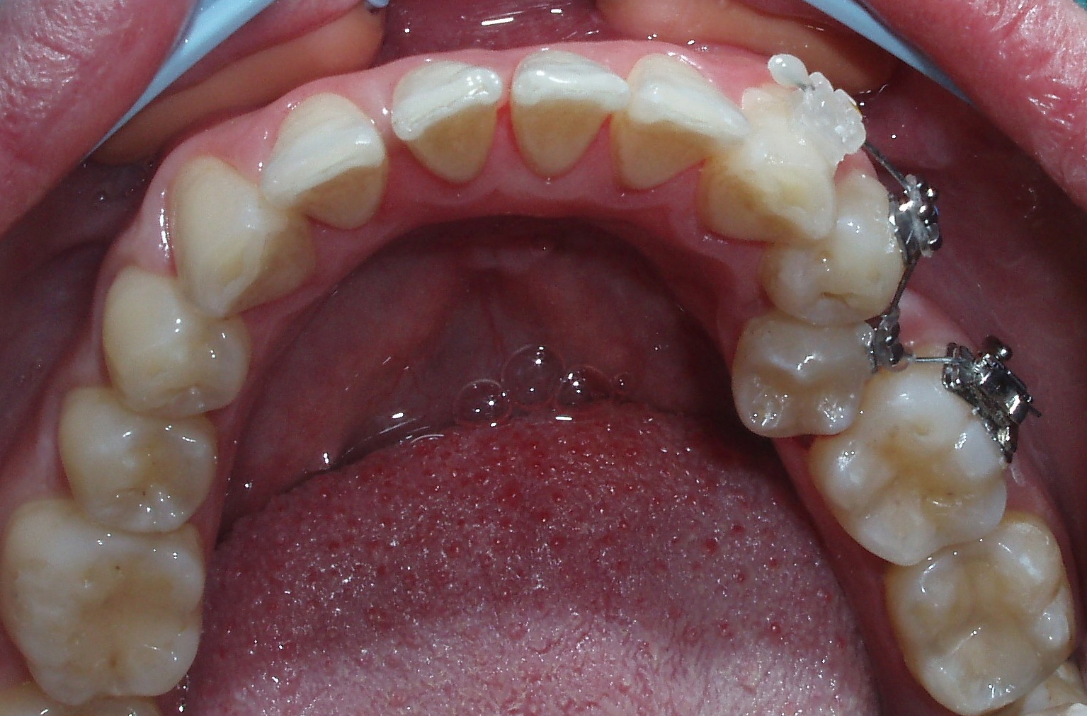 Детская стоматология и ортодонтия в Киеве - блог доктора Пешко Татьяны ...