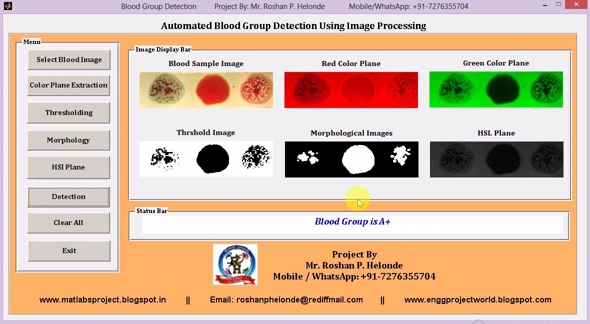 Matlab Code for Blood Group Detection and Classification Using Image ...
