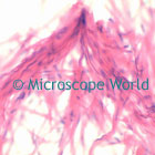 Microscopy image of smooth muscle.