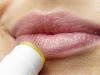  9 Best Home Remedies to Get Rid of Lip Wrinkles